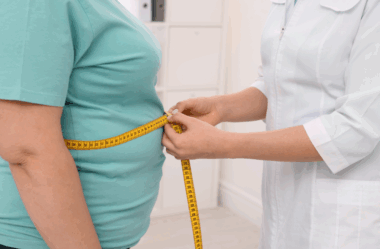 Plano de saúde cobre cirurgia bariátrica? 